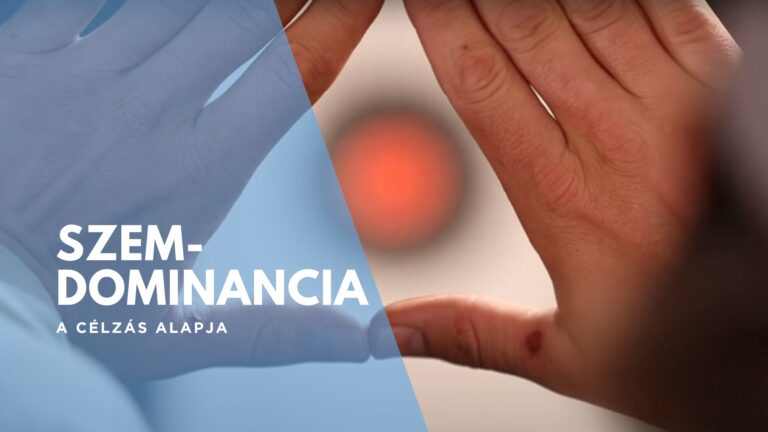 Szemdominancia - 9